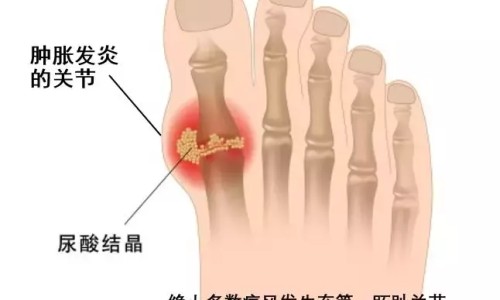糖尿病人不吃主食可以不打胰岛素吗-糖尿病人不吃主食网糖尿病人不吃主食还用吃药吗知识网站,分享糖尿病人不吃主食可以不打胰岛素吗大全